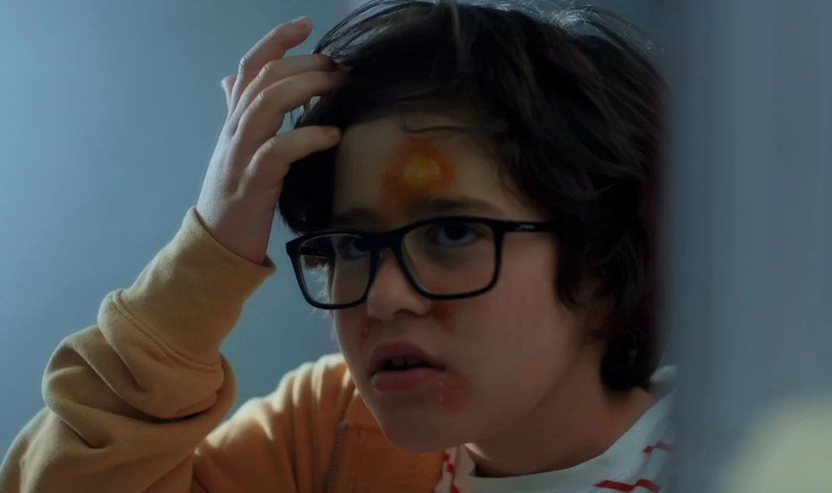 Pimple